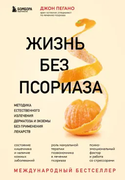 Жизнь без псориаза: методика естественного излечения дерматоза и экземы без применения лекарств